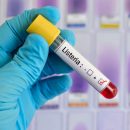 Listeria monocytogenes