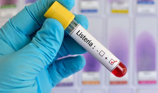Listeria monocytogenes