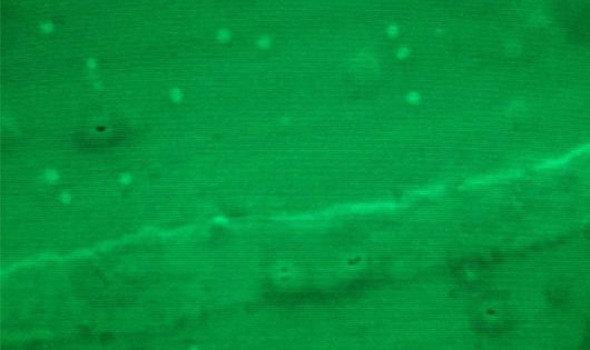 Microplastiche al microscopio